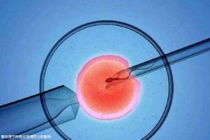 正规供卵代生子